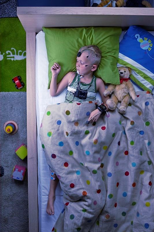 NoxA1,Ped2-Whole_opt(1)