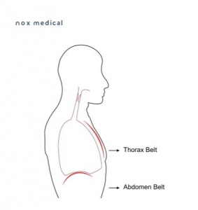 Nox RIP belts using Respiratory Inductance Plethysmograph RIP technology
